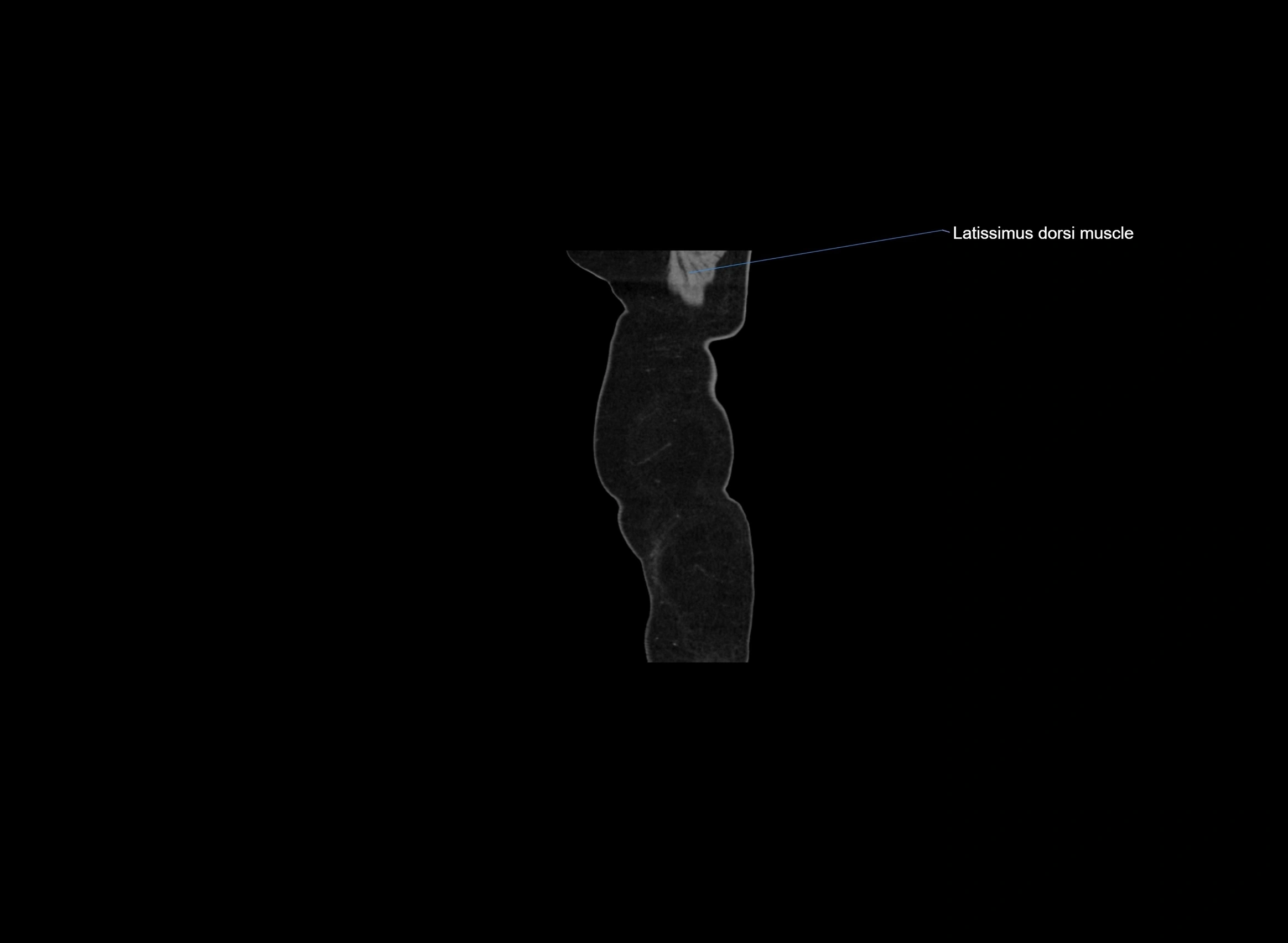CT Abdomen sagittal cross sectional anatomy labelled radiology image -00111.webp